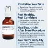 VULNAMIN® Spray 30ml | Made in Italy – Skin regeneration ,Soothe & Heal Your Skin After Laser Treatments, Chemical Peels & Microneedling
